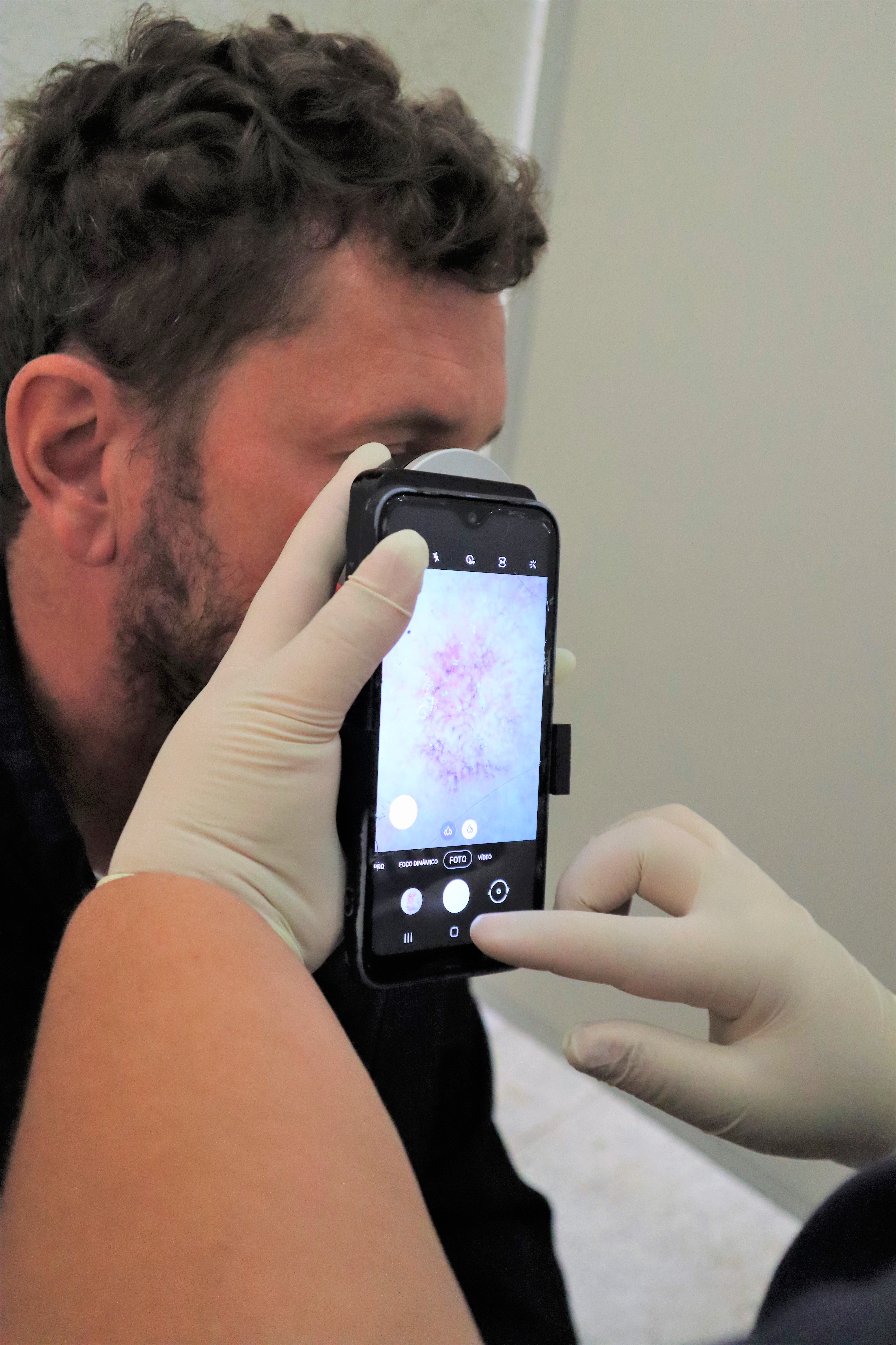 Paciente Thiago passando por avaliação de Teledermato com a Enfermeira da Unidade Móvel do Hospital de Amor de Barretos em Urupês - Foto: Carina Costa